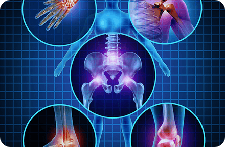 A blue background with multiple images of different joints.